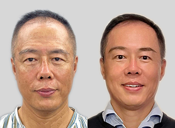 62-year-old man forehead, face, and neck lift surgeries_1