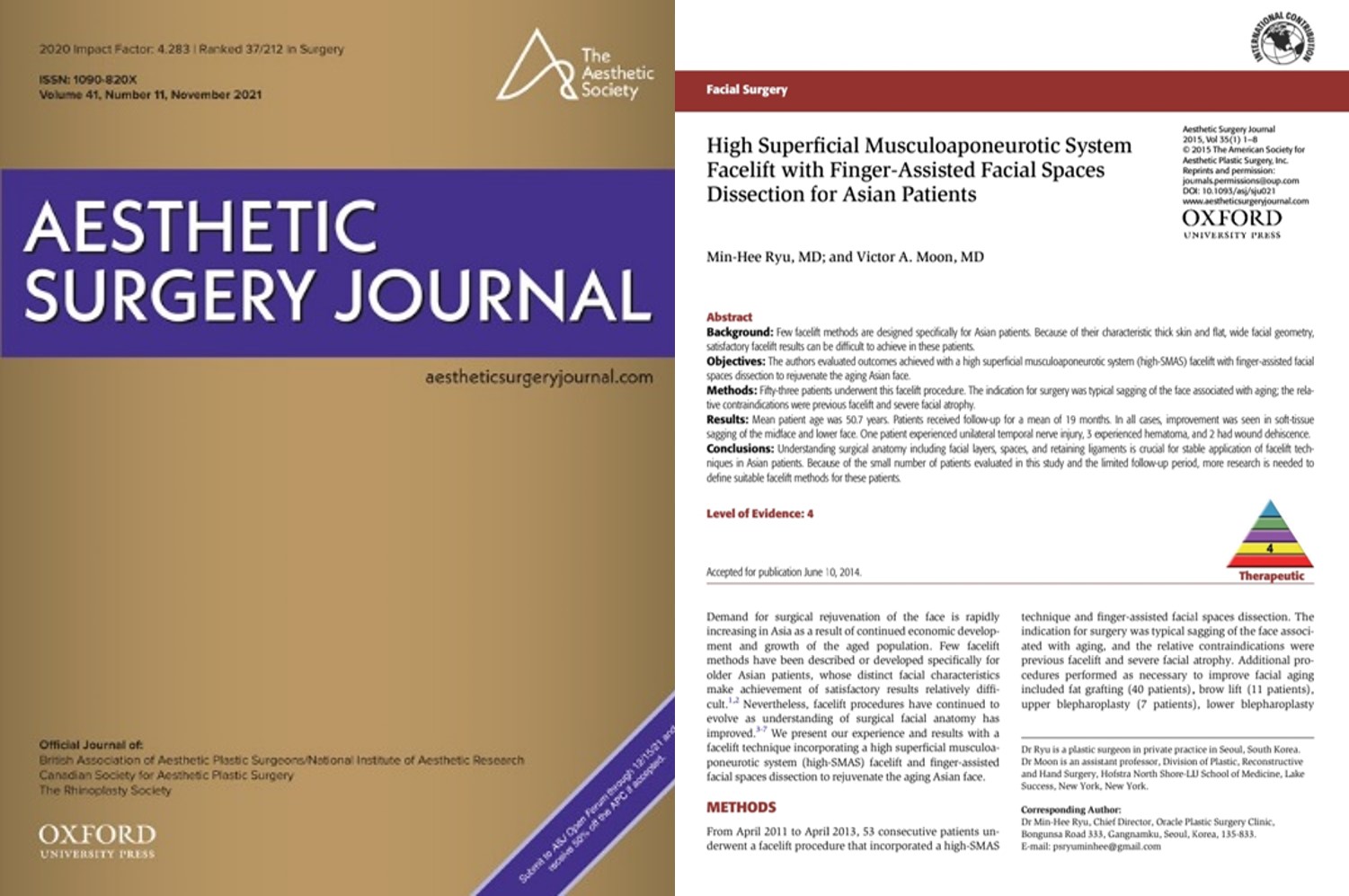 High-SMAS Facelift with Finger-Assisted Facial Spaces Dissection for Asian Patients