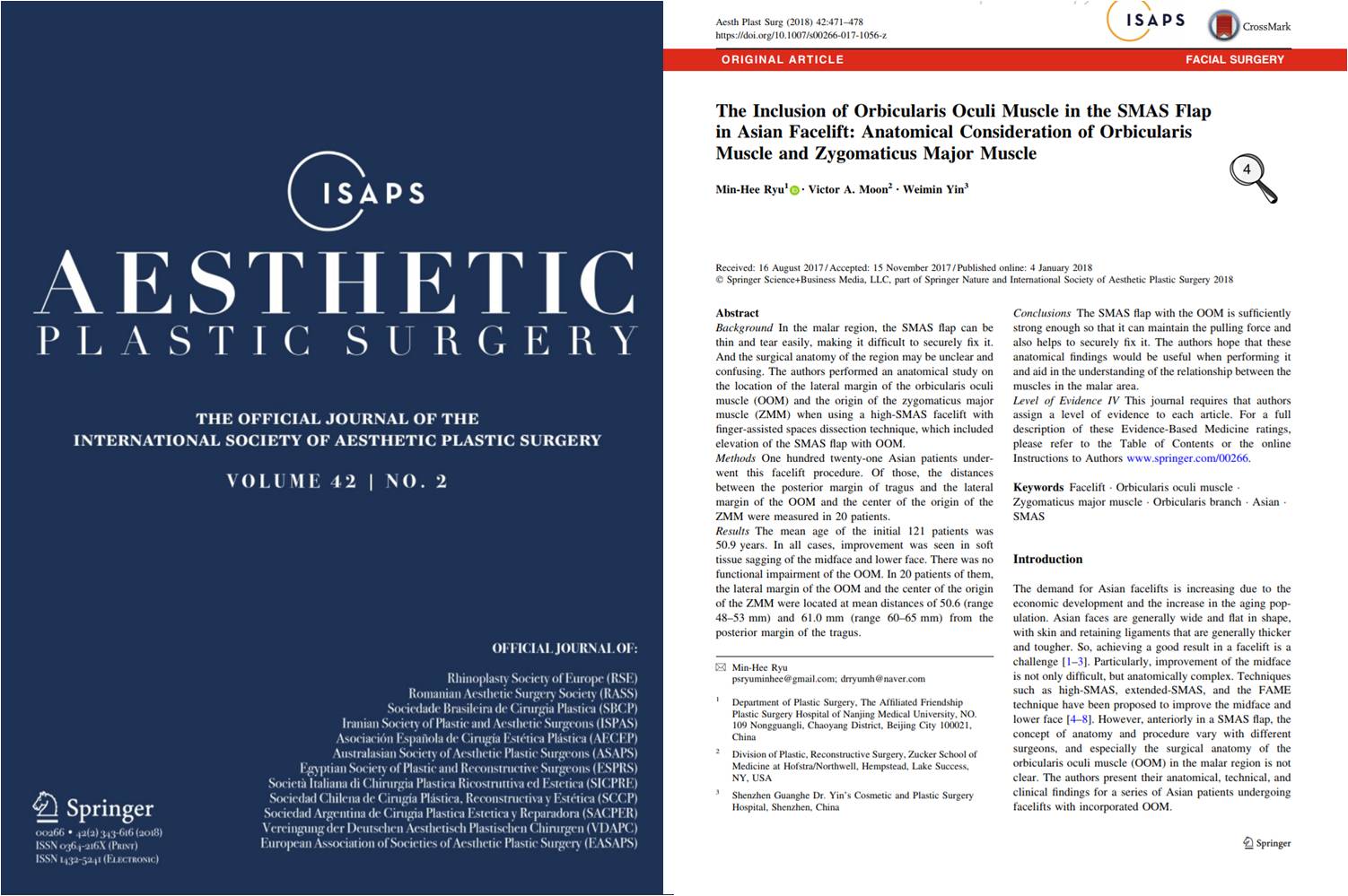 Inclusion of Orbicularis Oculi Muscle in the SMAS Flap in Asian Facelift